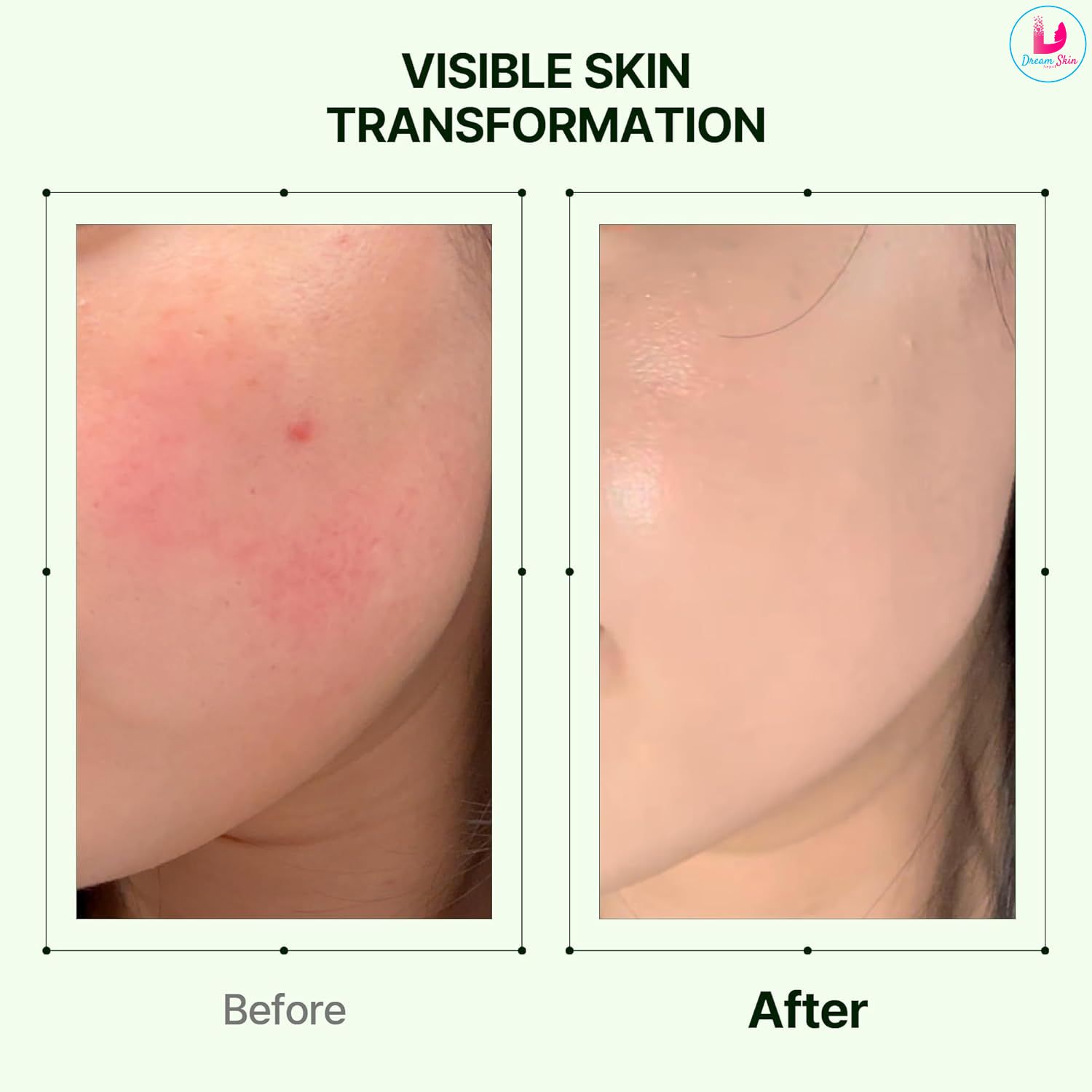 Orien Mugwort Zero Film Moisturizer [60ml]	